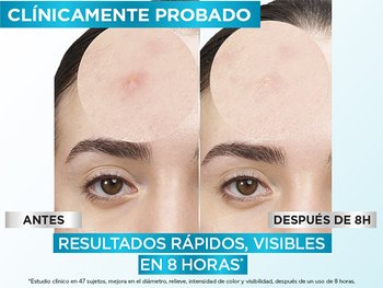 4 LANDING ANTI IMPERFECCIONES