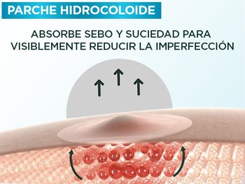 6 LANDING ANTI IMPERFECCIONES