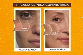 Cómo mejorar el aspecto de la piel con vitamina C