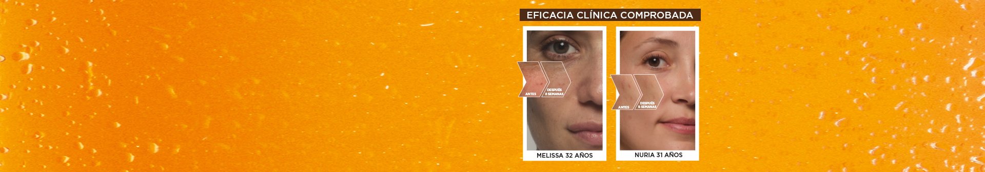 Beneficios de la vitamina C en la piel