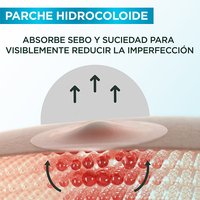 Como funciona el parche para granos