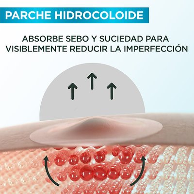 Como funciona el parche para granos