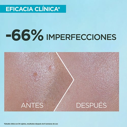 IMAGEN 4 SUPER UV ANTI ACNE PRODUCT PAGE